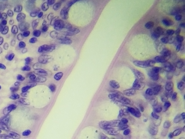 Simple Columnar Epithelium Slides - Simple Columnar Epithelium 04 400X
